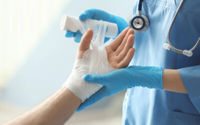 Burn Injuries in San Diego: Navigating the Legal Labyrinth Towards Recovery and Compensation