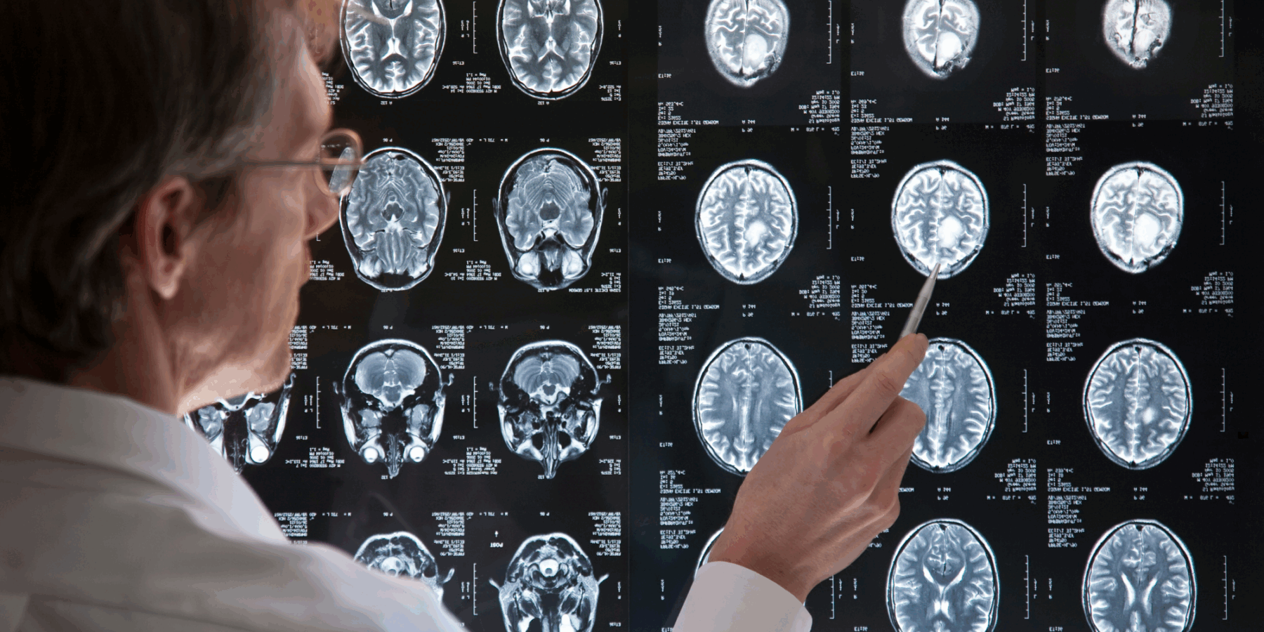 traumatic brain injury scan by doctor
