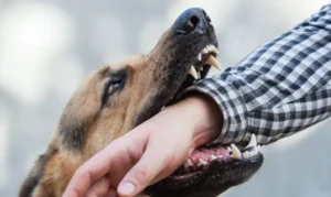 Dog Bite Lawyer in San Diego