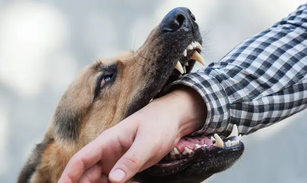 Dog Bite Lawyer in San Diego