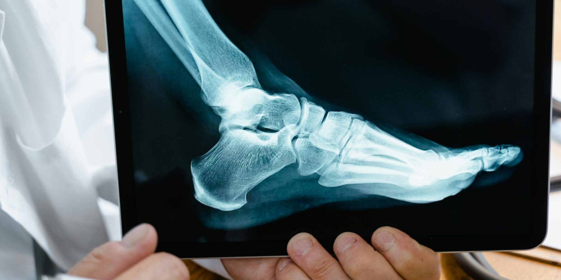 del mar personal injury